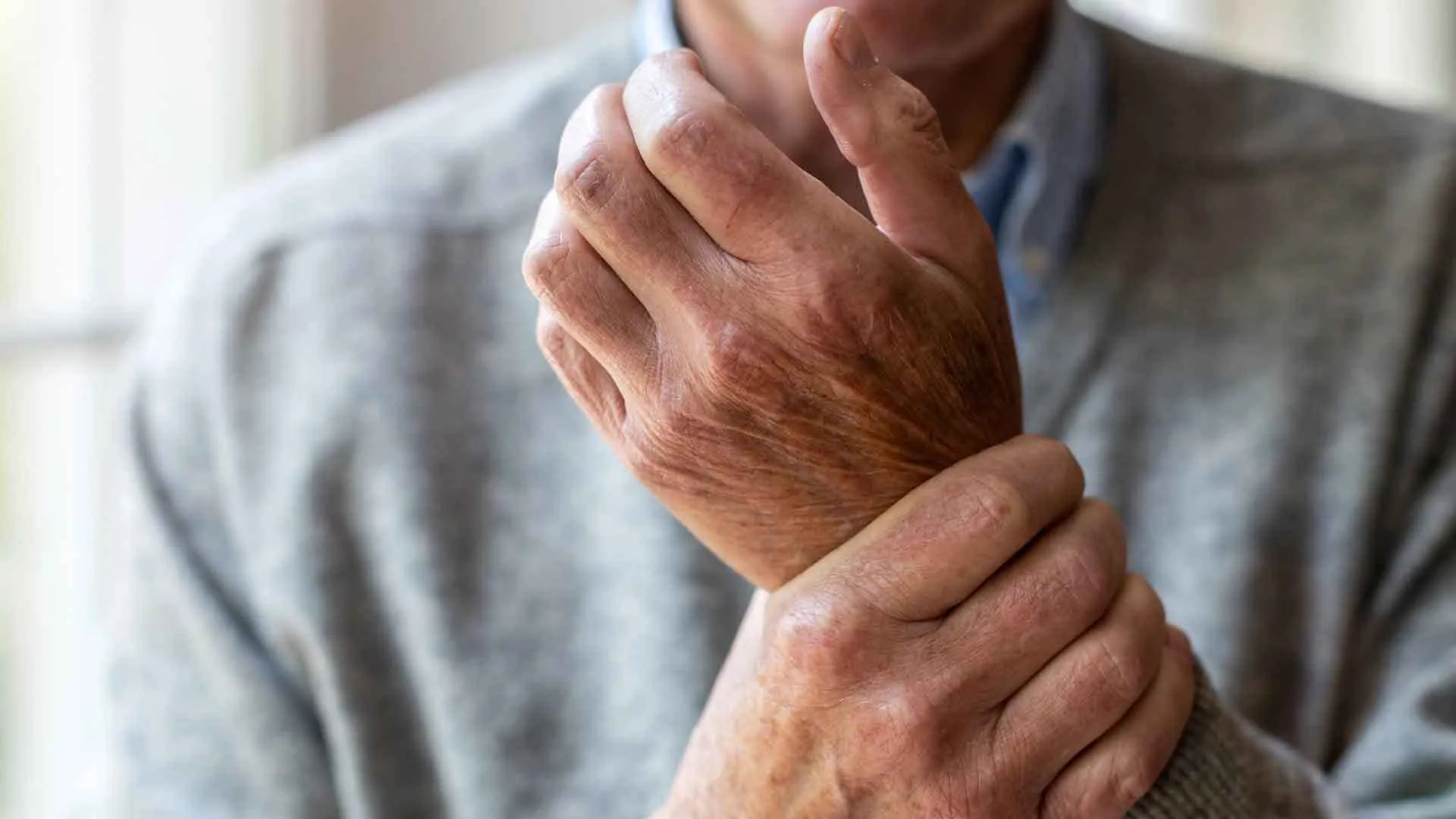 Rheuma: Symptome der rheumatoiden Arthritis frühzeitig erkennen