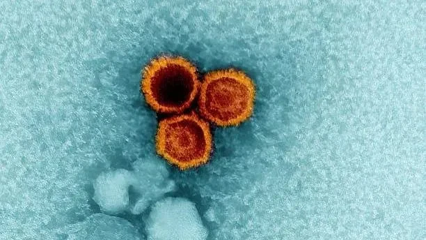 According to scientists, the Epstein-Barr virus could trigger the disease lupus